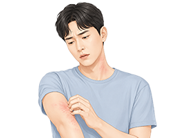 두드러기